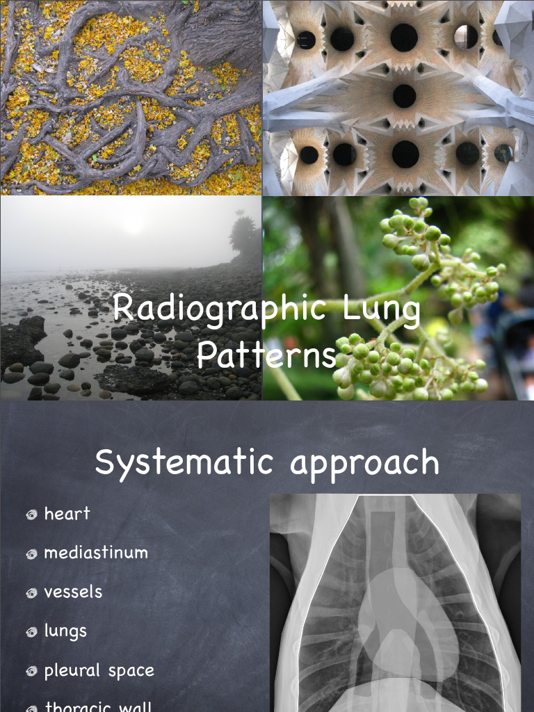May 2012 Rounds Lung Basics PP Presentation | PDF | Lung | Blood Vessel