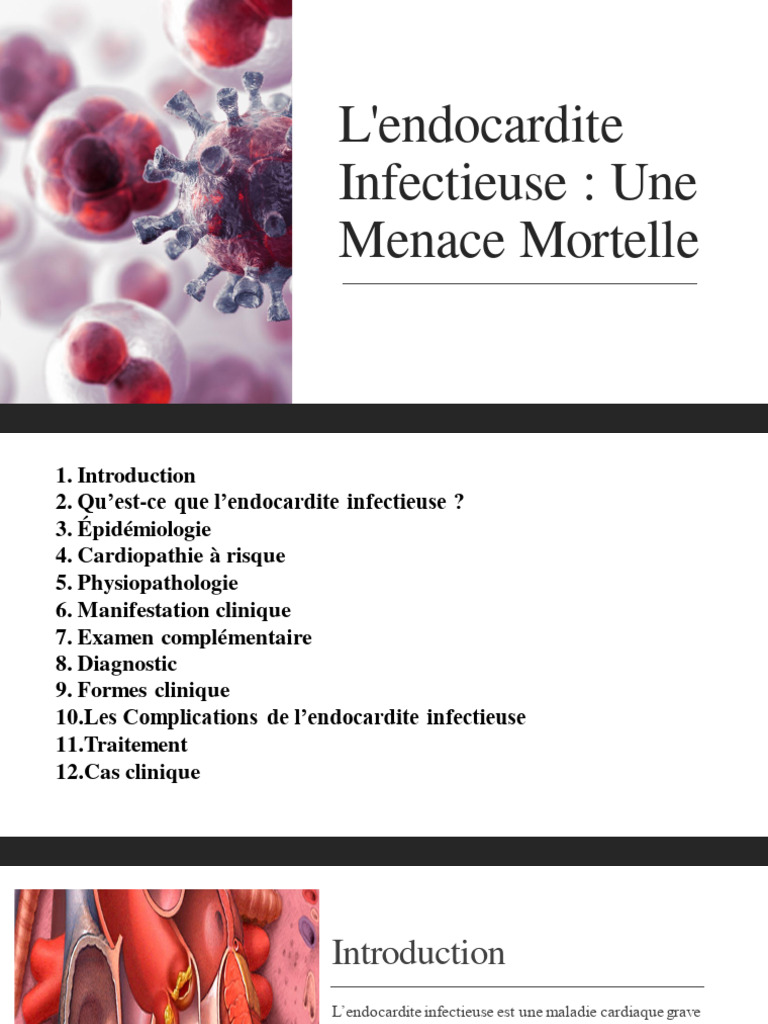 Endocardite Infectieuse : Diagnostic et Traitement | PDF | Sciences et ...