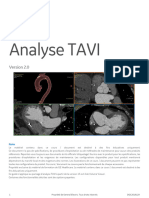 TAVI 2 Analysis FR