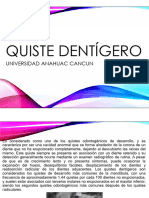 Quiste Dentigero Diapositivas