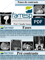 Aula 20 - As Fases Do Contraste Na TC de Abdome-1