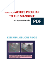 Radiopacities Peculiar To The Mandible