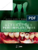 Implanto25- Diagnóstico e Tratamento das Alterações Peri-Implantares - Bianchini