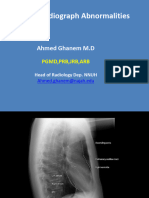 002 Chest Radiograph Abnormalities-1