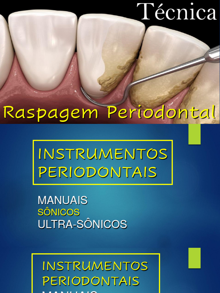 INSTRUMENTAÇÃO PERIODONTAL | PDF