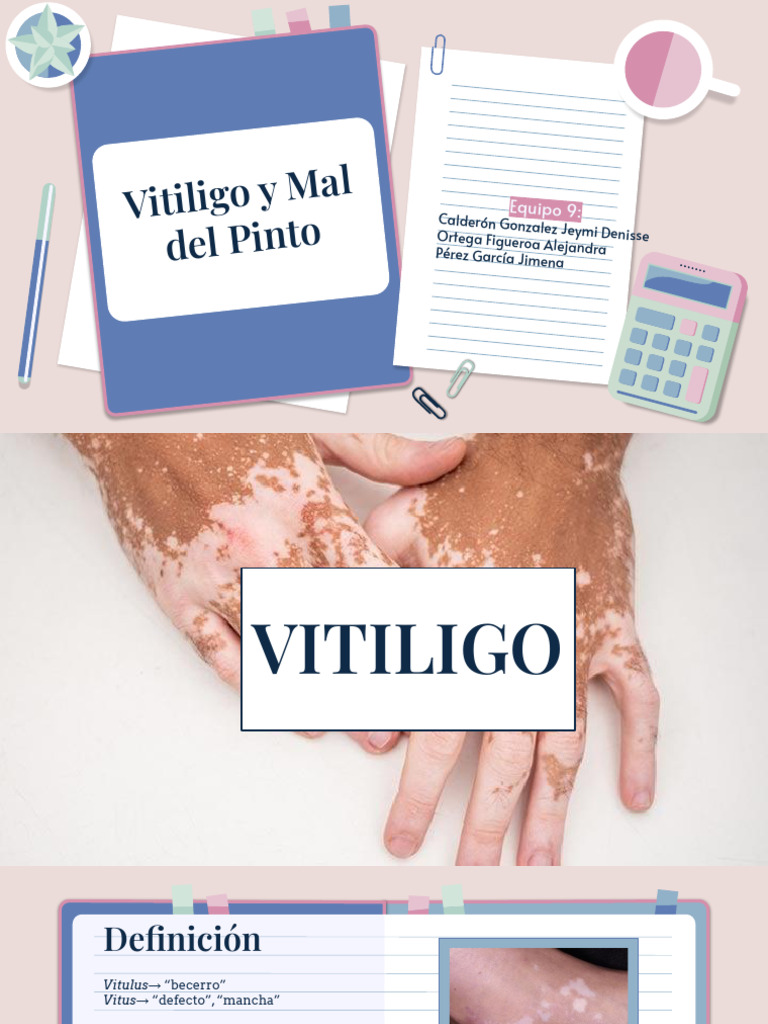 Equipo 9. Vitiligo y Mal del Pinto (1) PDF Epidemiología Dermatología