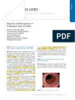 Diagnosis and Management of Esophageal Rings and Webs