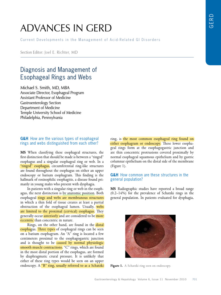 Diagnosis and management of esophageal rings and webs pdf esophagus