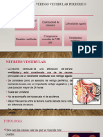 Neuritis Vestibular