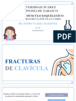 Fracturas de Clavicula y Hombro