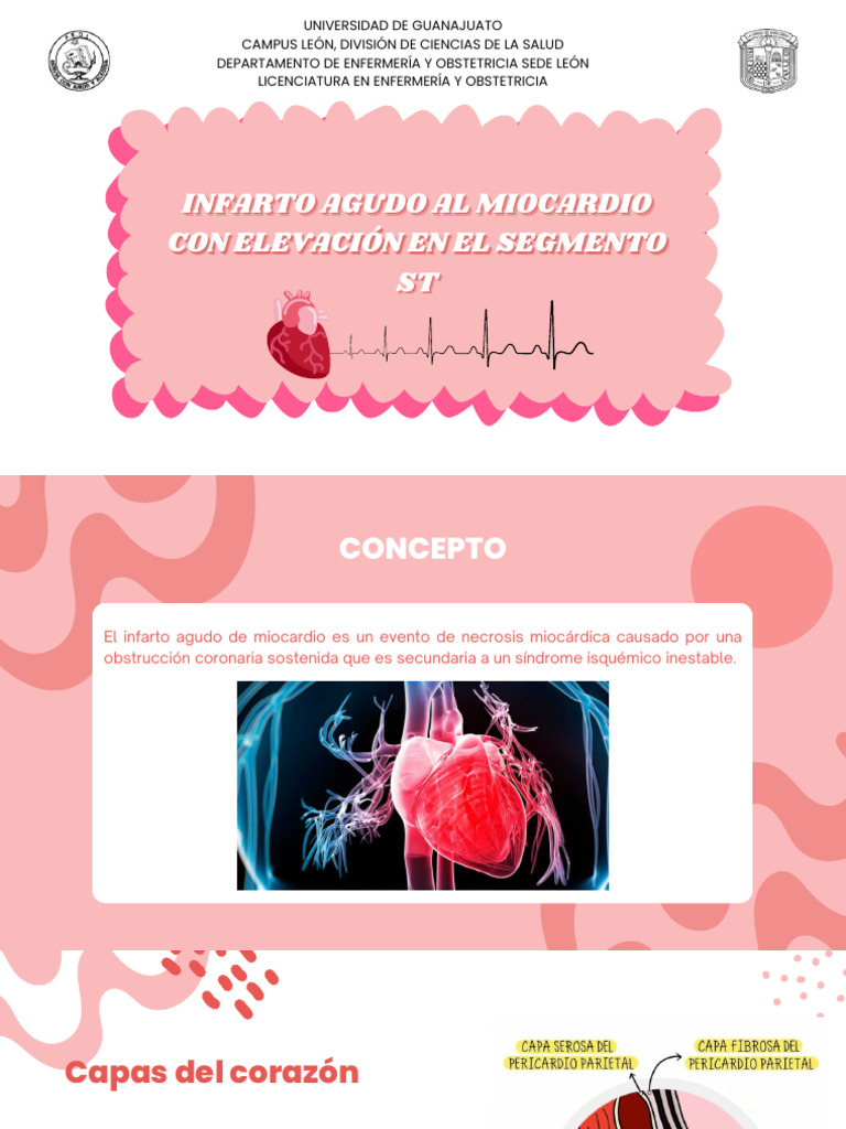 Infarto Agudo Al Miocardio Con Elevación en ST | PDF | Infarto de ...