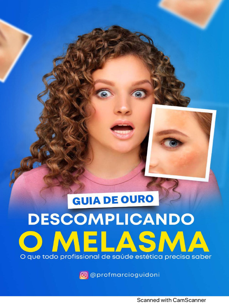 guia-de-ouro-melasma-prof-marcio-guidoni-pdf