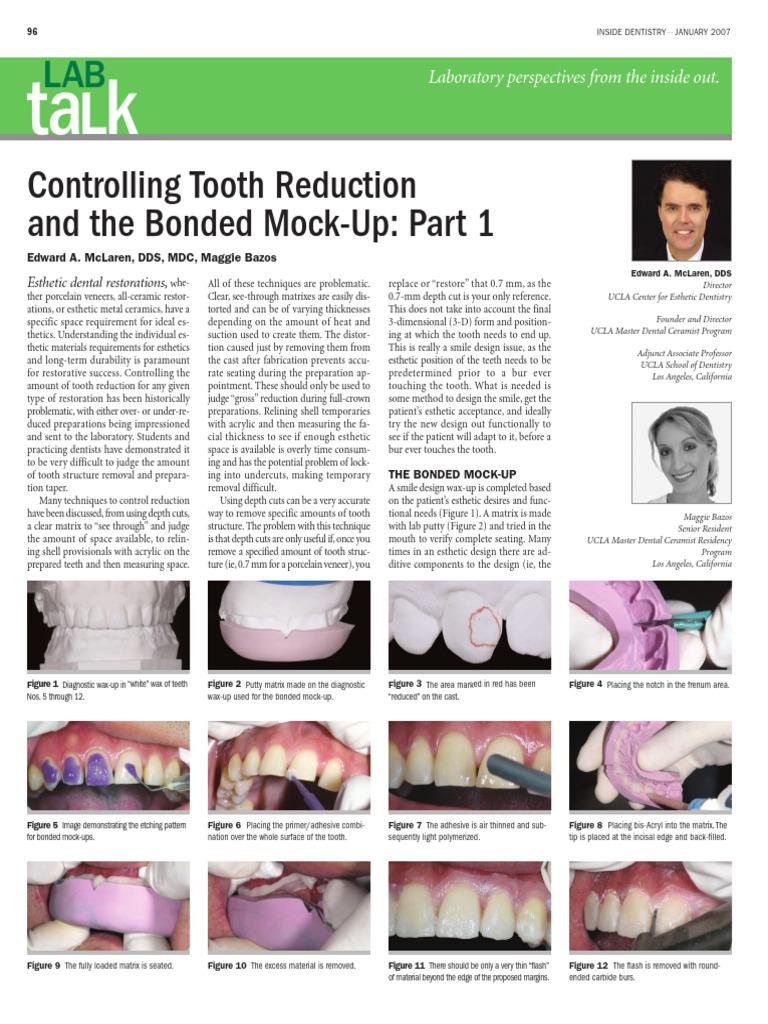 Controlling Tooth Reduction | PDF | Dentistry | Dentistry Branches