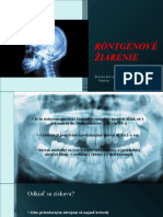 Räntgenove Žiarenie