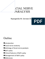 Facial Nerve Paralysis ... Nyangwida