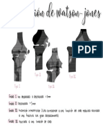 Clasificación de Watson-Jones 2