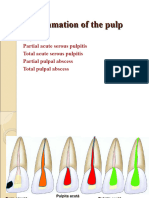 Curs 10-Pulp Pathology II-1