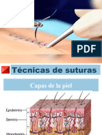 Técnica de Suturas