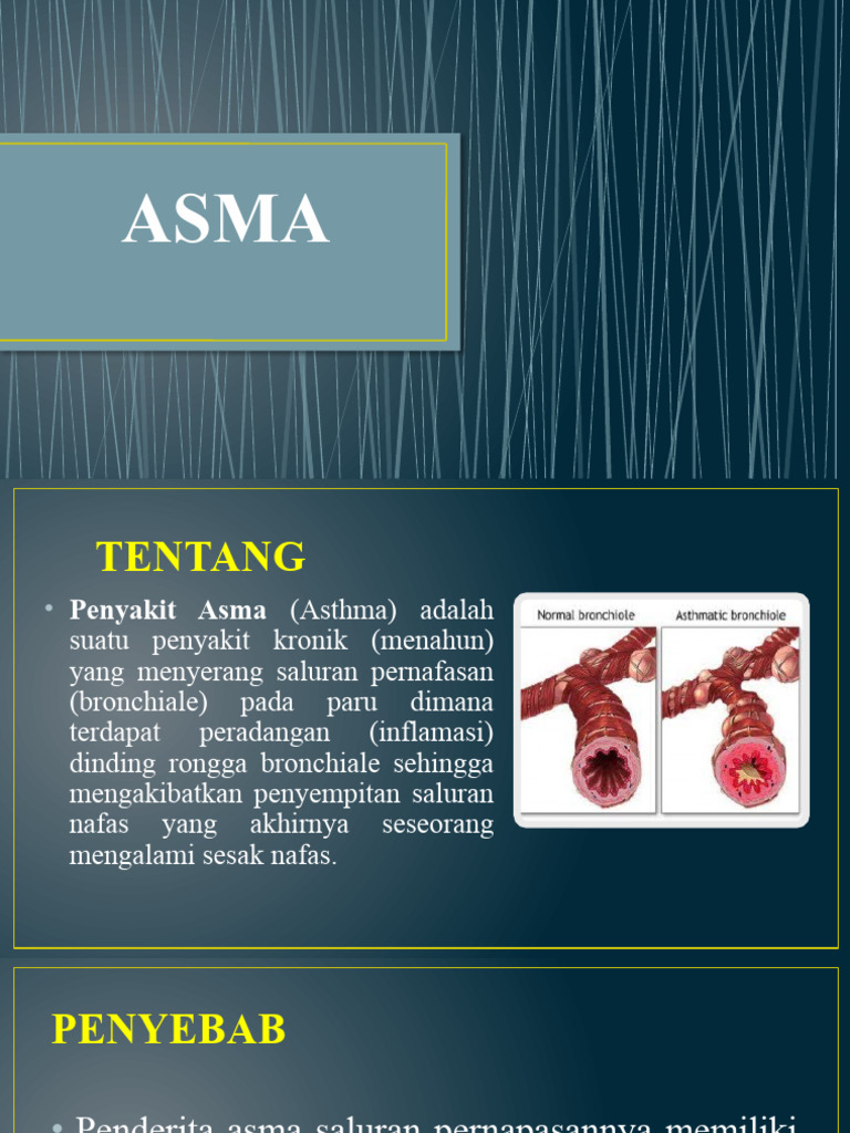 Asma | PDF