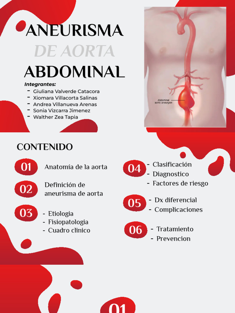Síntomas y diagnóstico de aneurisma abdominal | PDF | Aorta | Abdomen