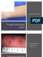 Fungal GLS Questions 2021