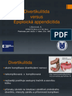 Divertikulitida vs. Epiploicka Appendicitida