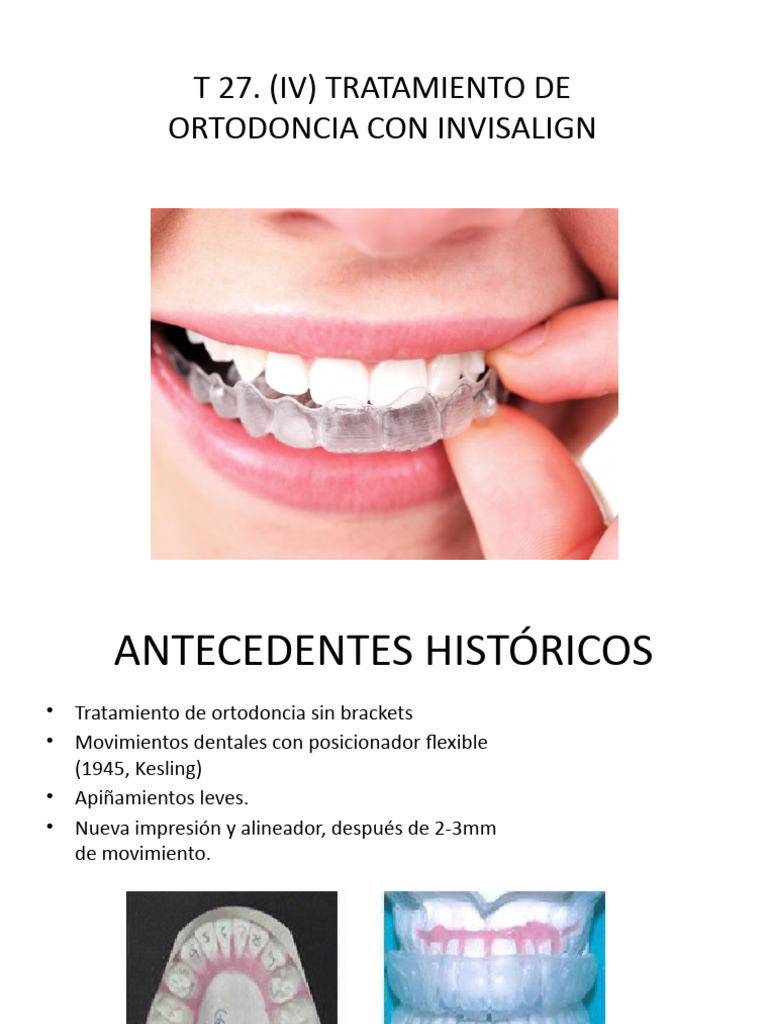 t.27 (IV) - Invisalign | PDF