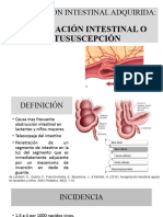 Invaginación Intestinal CX Pediatrica