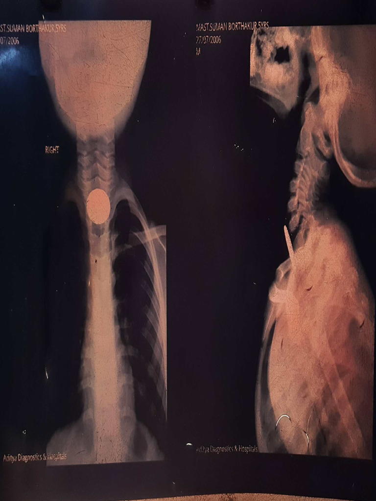 ENT X-Rays | PDF