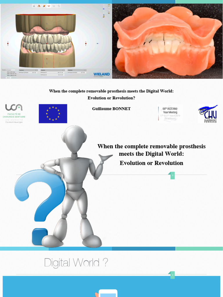 Bonnet G IADS DIGITAL DENTURE 2019-2020 | PDF | Computing | Dentistry ...