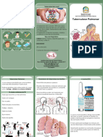 Tuberculose Pulmonar