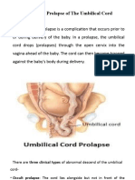 Presentation and Prolapse of The Umbilical Cord