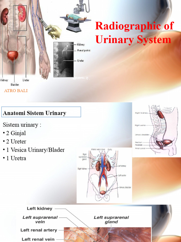 Radiografi Patologi Sistem Urinari | PDF