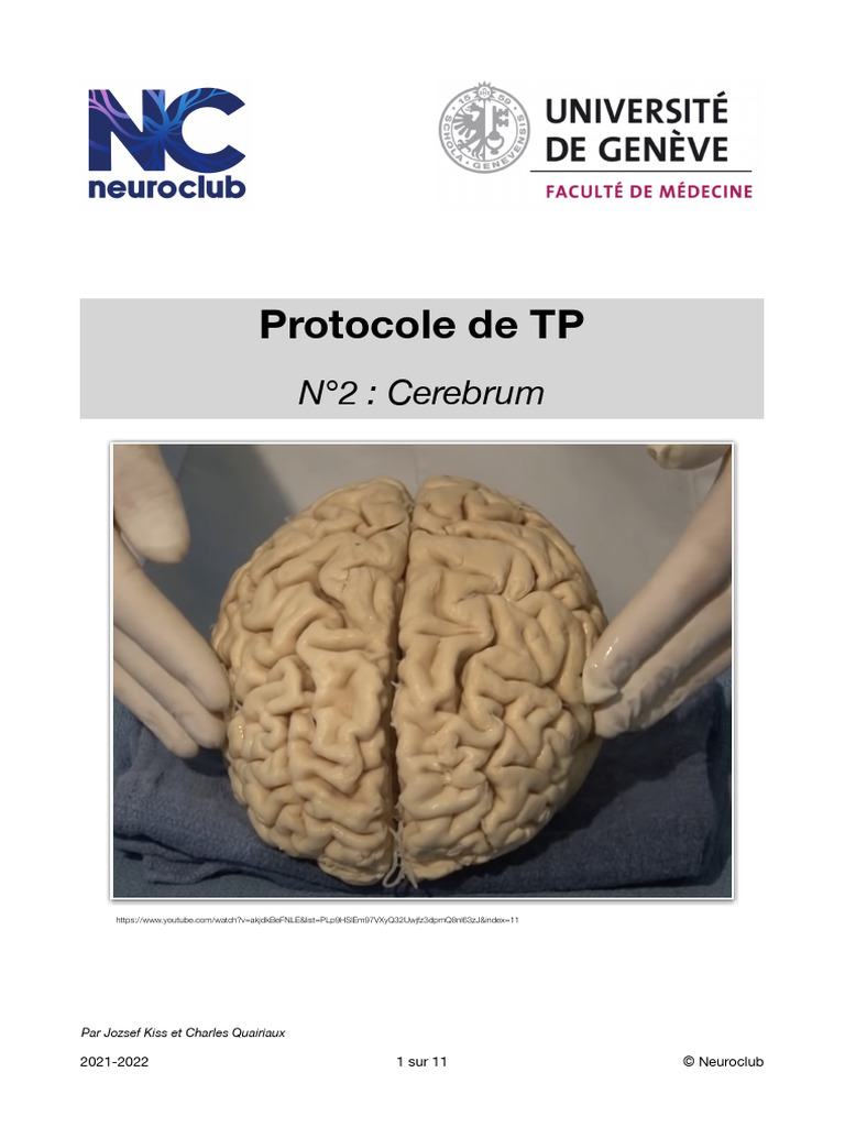 TP Neuroanatomie : Exploration du Cerveau | PDF | Circonvolution ...