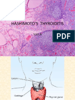 Hashimotosthyroiditis 170825171347