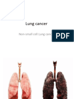 Non-Small Cell Lung Cancer