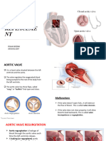 Aortic Valve Replaceme NT: Disha Modak A9539321007