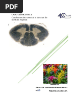 Laminas de Rexed en la Médula Espinal | PDF | Materia gris | Médula espinal