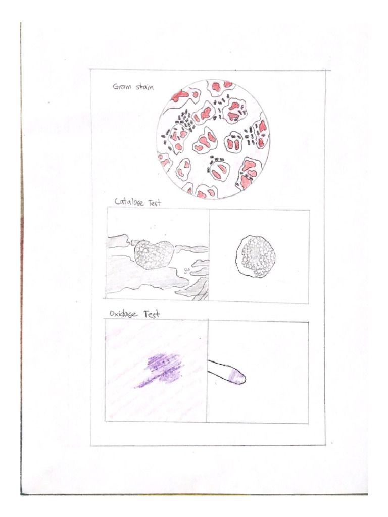 Gram Stain PDF