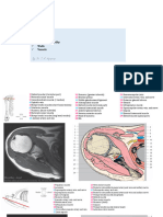 Limbs - CT & Mri