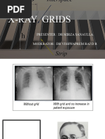Understanding Grid Errors in Radiology | PDF | X Ray | Radiography