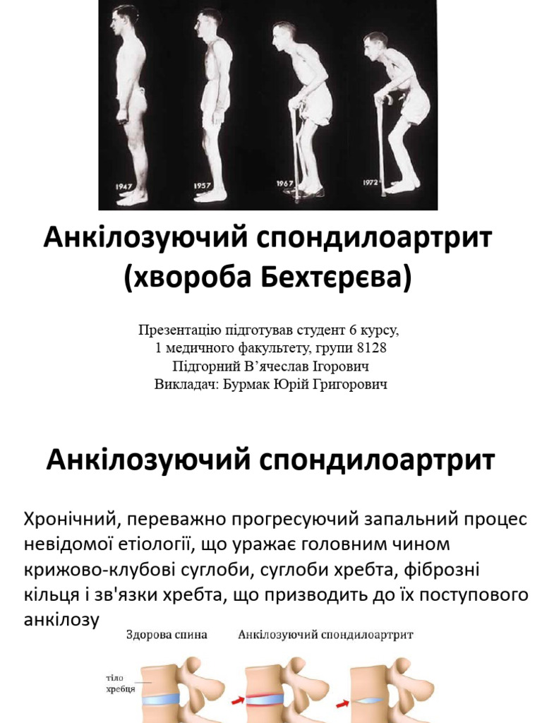 Підгорний хв Бехтерева | PDF
