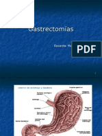 Gastrectomasaula
