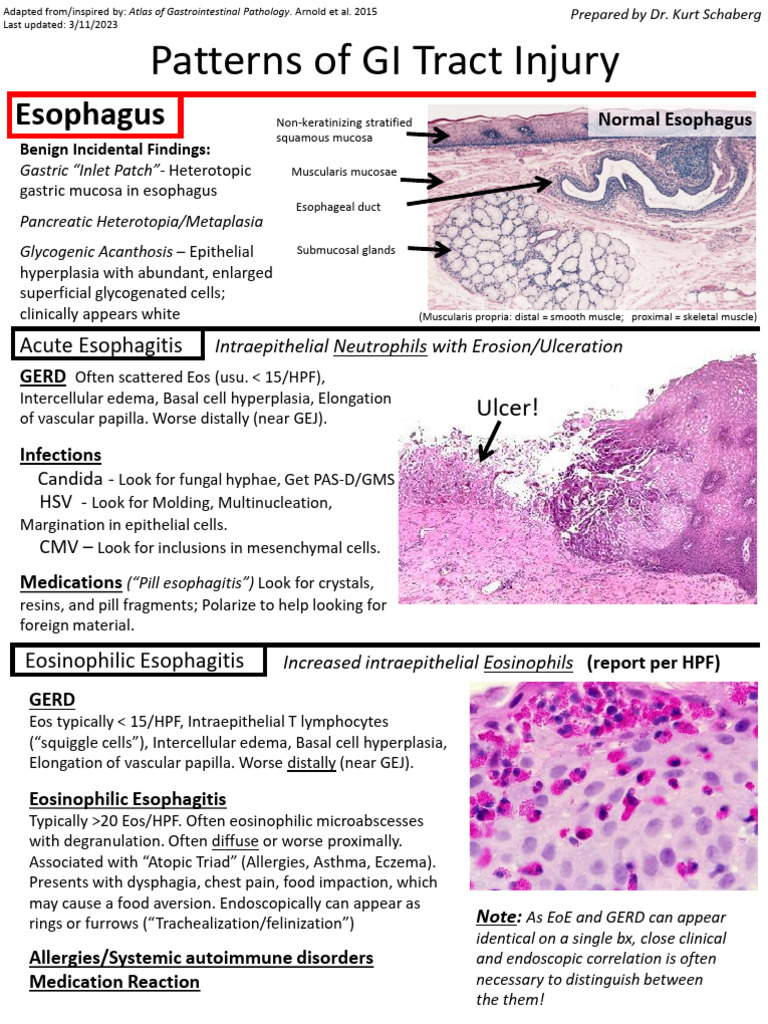 Inflammatory GIT Handout2 | PDF | Crohn's Disease | Esophagus