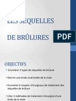 Séquelles Brulure