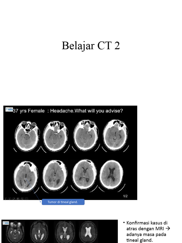 Belajar CT 2 | PDF