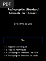 Signe de la silhouette en radiologie | PDF | Aorte | Thorax