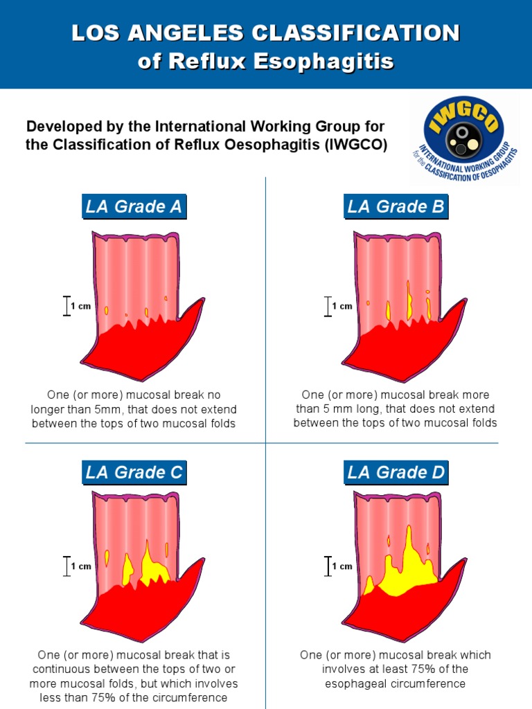 LA Classification Esofagitis