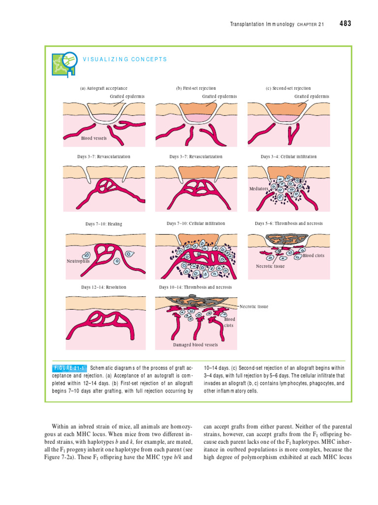 Acceptance of Graft PDF Transplant Rejection Major