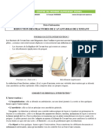 Fractures Avant Bras Enfant Reduction